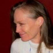 Suzy Amis